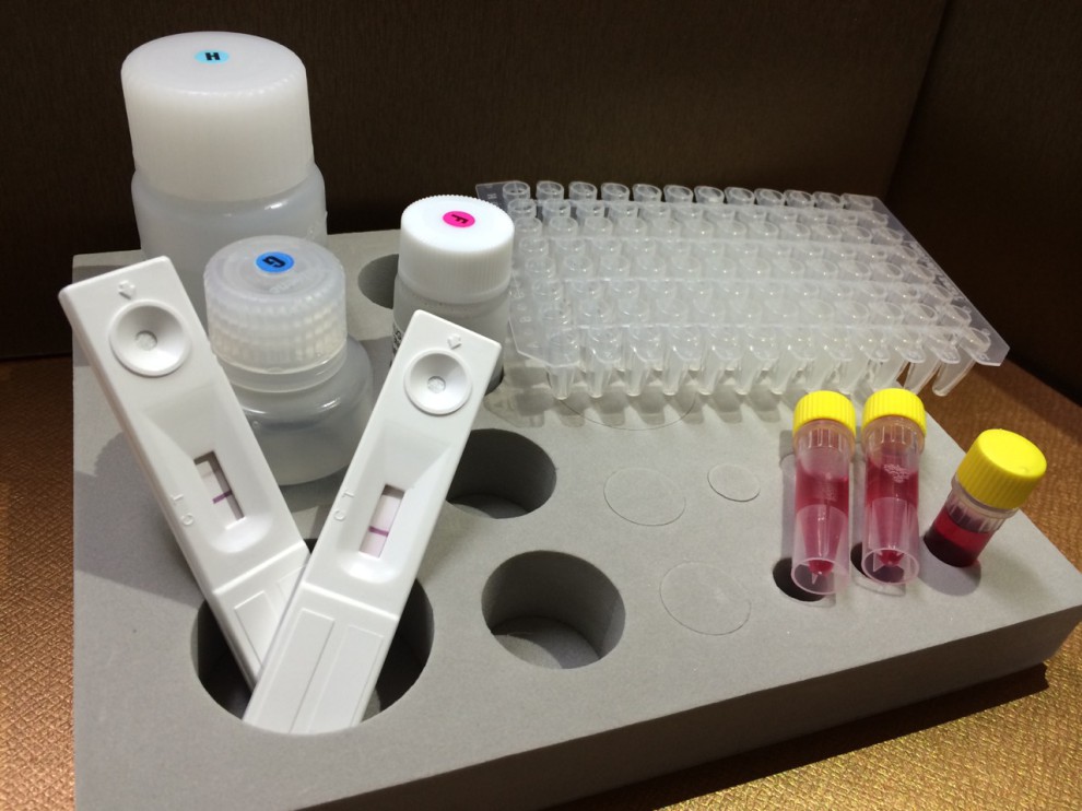 肺結核TB pCRIC Test 檢測套組